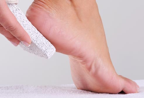 Remove Calluses or Corns