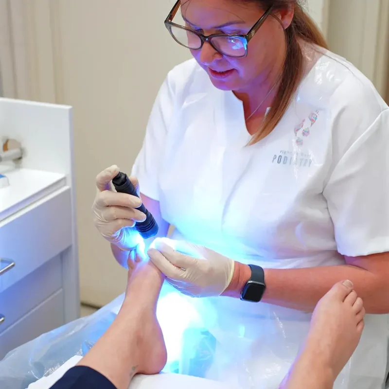 Podiatrist performing Onyfix toenail correction at Brighton Road Podiatry Clinic